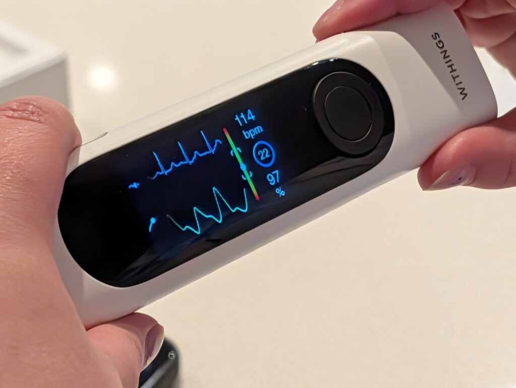 Review: Withings BeamO – A Compact Dynamo for Health Monitoring